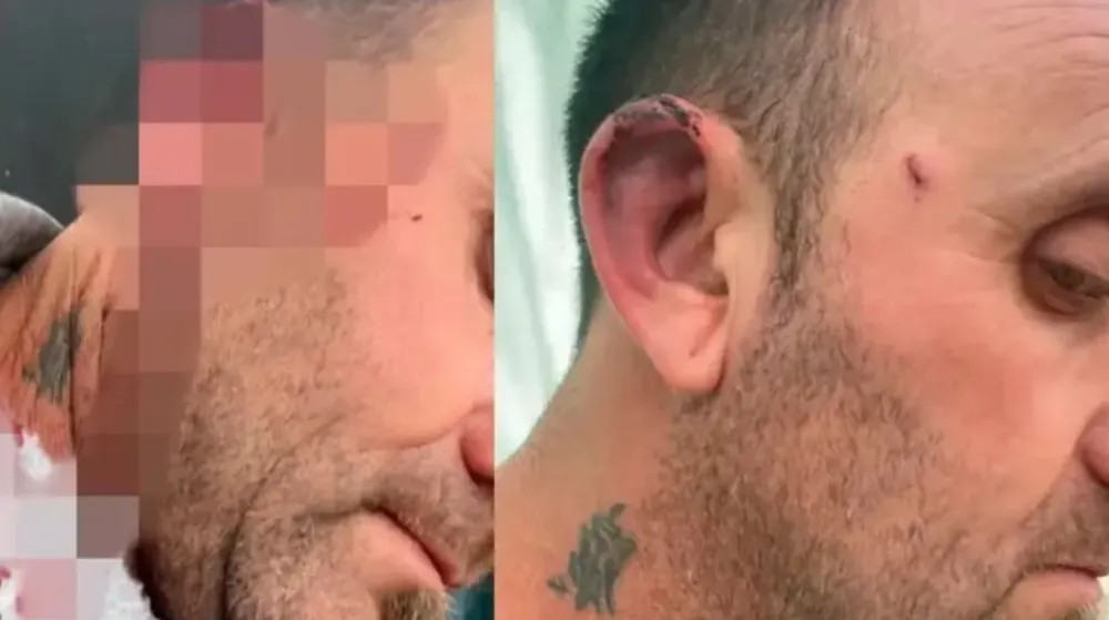 Un concejal golpeó al intendente durante una reunión en Colonia&nbsp;Elía